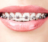 Ortodontia‎ em Contagem